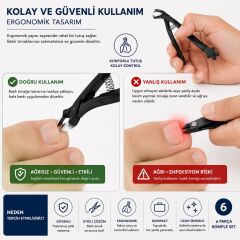 Muggio 6 Parça Batık Tırnak Seti - Batık Tırnak Makası, Pensi, Düzeltici ve Törpü